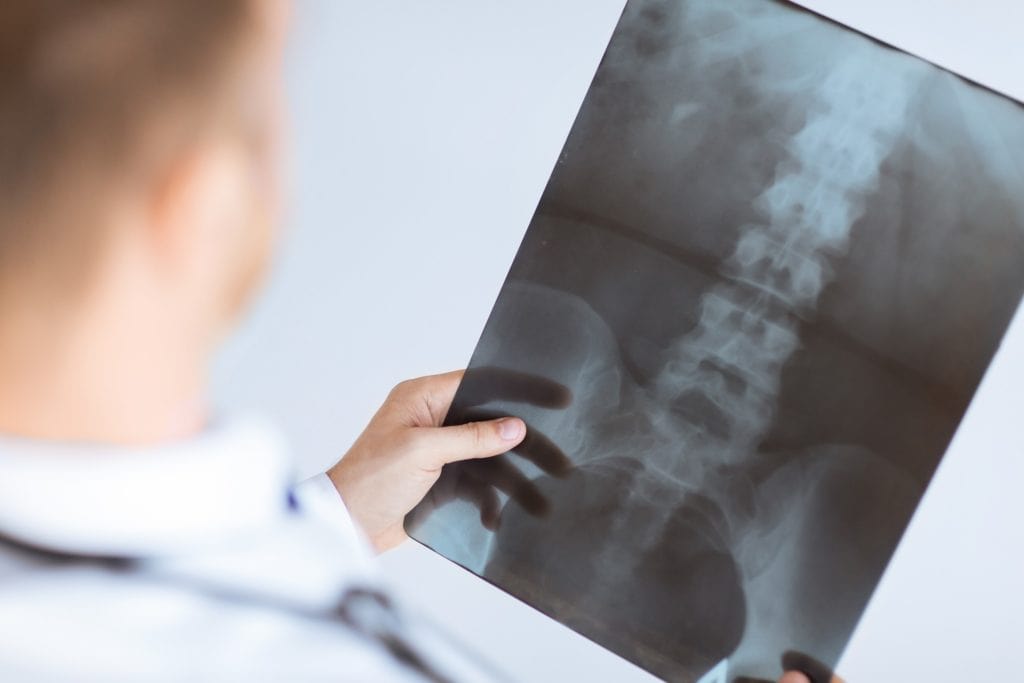 Hip Implant Injury Lawyer Hip Implant Injury Lawyer