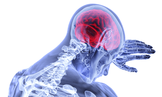 Miami traumatic brain injury lawyer Miami traumatic brain injury lawyer